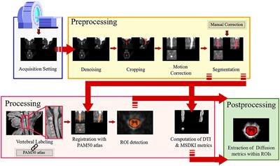 Diffusion Kurtosis Imaging of Neonatal Spinal Cord in Clinical Routine